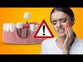 EVERYONE WANTS TO KNOW: Will Dental Implants Hurt?