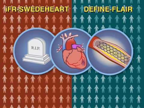 Approaches to Guided PCI