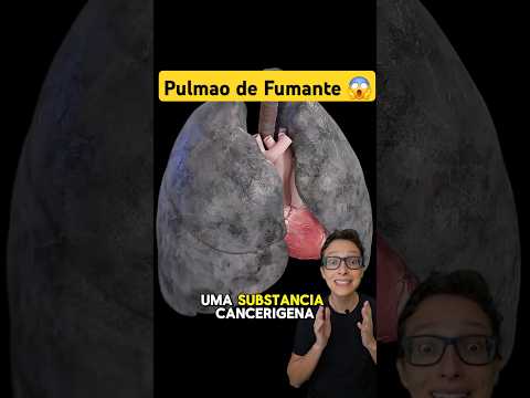 Pulmão de Fumante 😱 #medicina #medico #enfermagem #enfermeiro #enfermeira #dpoc #pneumonia #asma