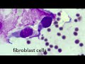 Fibroblast Cells Morphology