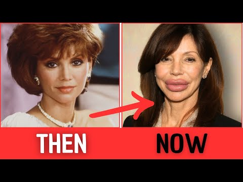 DALLAS (1978) – CAST THEN AND NOW (2025) - 47 Years Later – Some Changes Will Shock You!