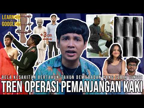 TREN POTONG KAKI Biar Tambah Tinggi Di India! Pendek = Hidup Susah? | Learning By Googling