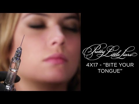 Pretty Little Liars - 'A' Attacks Hanna At The Dentist - "Bite Your Tongue" (4x17)