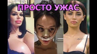 7 САМЫХ НЕУДАЧНЫХ ПЛАСТИЧЕСКИХ ОПЕРАЦИЙ ЗВЕЗД ДОМА-2