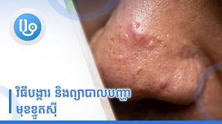 វិធីបង្ការ និងព្យាបាលបញ្ហាមុខខ្មូតស៊ី