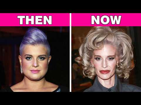 80+ Celebrity Transformations So Extreme Fans Are Worried | Then and Now