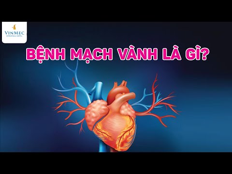 Bệnh mạch vành là gì? Vì sao bệnh mạch vành gây đột tử?