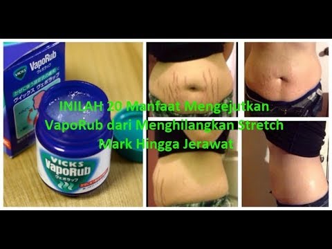 Menurunkan tanpa obat Apa latihan dapat menghapus lemak perut