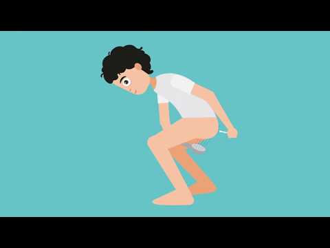 ProctyClean® Analreinigung Methode