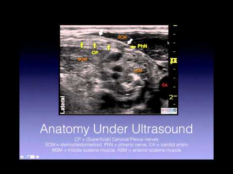 Tutorial: Superficial Cervical Plexus Block