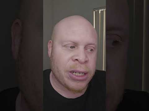 this is how I explain what a black albino is to a 5 year old.