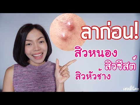 ไม่ว่าจะเป็นผ้าพันแผลกลาก โรคสะเก็ดเงินที่หู