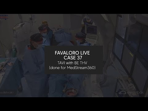 Favaloro Live Case N° 37 - TAVI with BE THV (done for MedStream360)