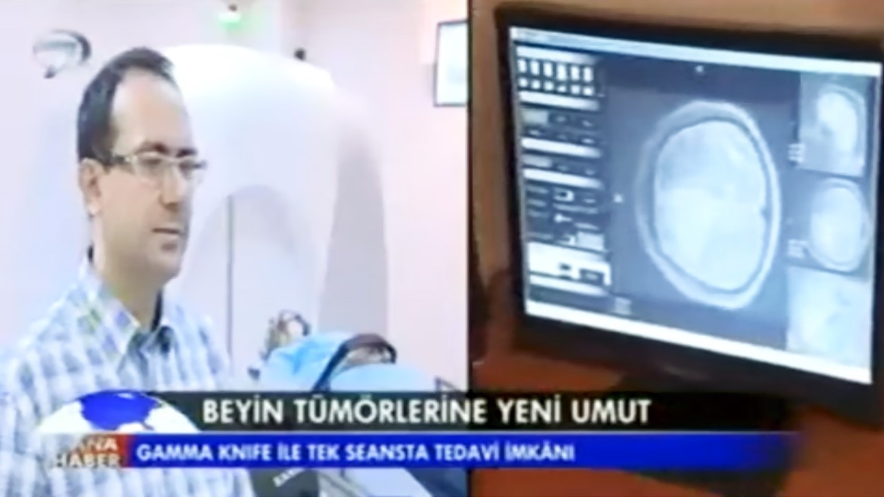 Beyin Tümörleri ve Gamma Knife Tedavisi