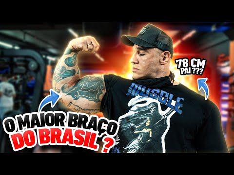 FABIO GIGA BUGOU RAMON COM BRAÇO GIGANTE