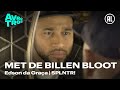 Met de billen bloot - Edson da Graça | SPLNTR!
