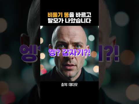 希波克拉底说？？？？？脱发就要吃鸽子屎！