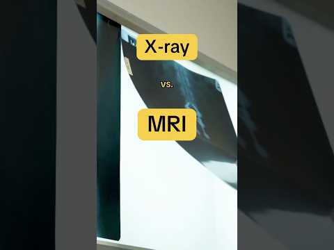 🩻 X-Ray vs. MRI 🧲