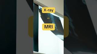 Download lagu 🩻 X-Ray vs. MRI 🧲 mp3