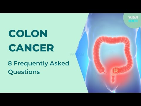 Colon Cancer- 8 Frequently Asked Questions
