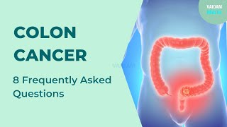 Colon Cancer - 8 Frequently Asked Questions