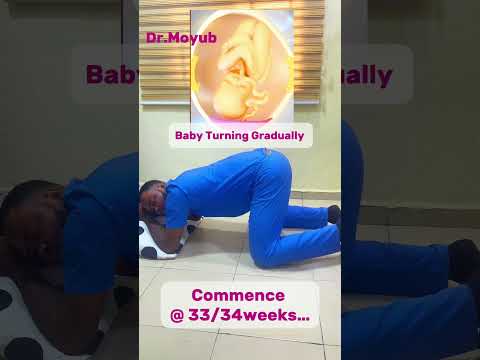 How to turn baby’s head down