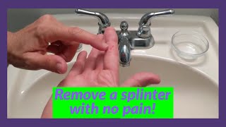 How to Remove a Splinter from your Finger Without Pain — all natural!