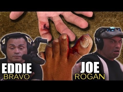 Joe Rogan on Freak injuries in MMA & Fighters stopping a fight vs pausing it.