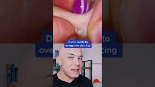 Download lagu Doctor reacts to an overgrown piercing pop! #piercing #pimplepop #cystpop #dermreacts mp3 Download lagu Doctor reacts to an overgrown piercing pop! #piercing #pimplepop #cystpop #dermreacts mp3