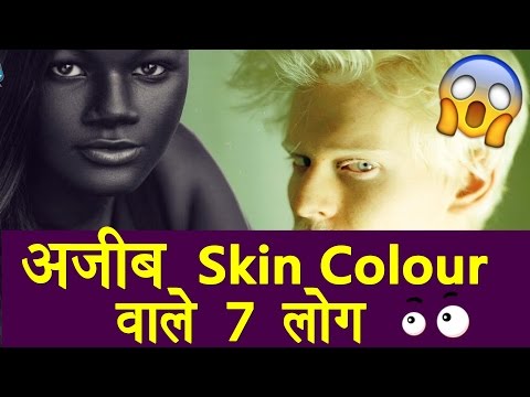अजीब तरह की  Skin वाले 7 लोग | 7 People With Unique Skin Colour Video
