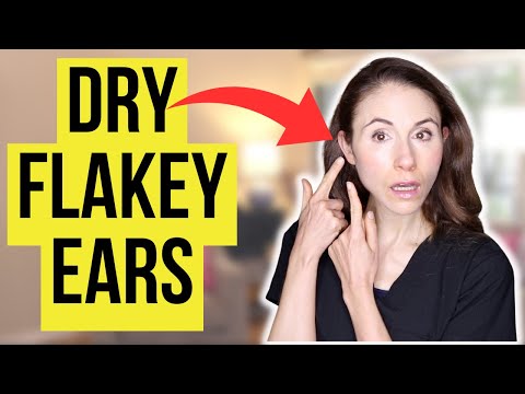 Why You Have Dry Skin In The Ears & How To Get Rid Of It