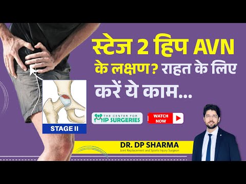 Stage 2 HIP AVN Signs, Symptoms & Treatment | Hip & Joint Pain Treatment In Delhi-NCR - Dr DP Sharma