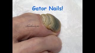 Gator Nail Nimbus, Onychogryphosis!?