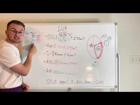 EKG Series: Left Ventricular Hypertrophy Criteria