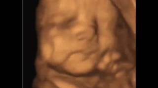 4D ULTRASOUND BABY MAKING MAD FACES and DRINKING AMNIOTIC FLUID.. SO CUTE!  BABY ULTRASOUNDS