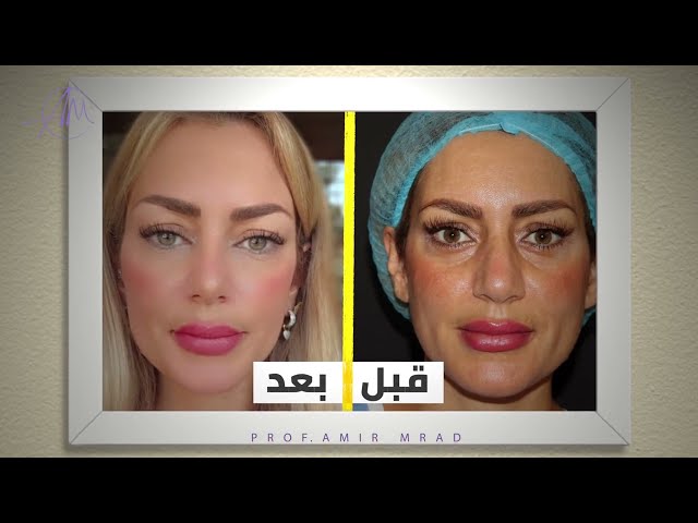 حجز استشارة إلكترونية مع البروفيسور أمير مراد