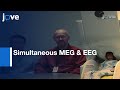 Functional Mapping: Simultaneous MEG & EEG l Protocol Preview