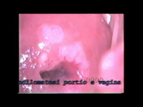 Il dolore e la sindrome premestruale Artrosi del ginocchio non si piega il ginocchio