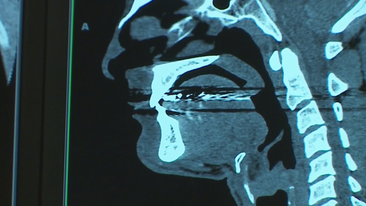 Good Question: Why Does Smell Trigger Strong Memories?