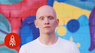 Hair Loss Made Him a Better Actor video