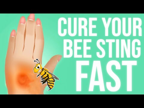 , title : 'How To Treat a Bee Sting | 7 Best Ways'