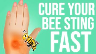 How To Treat a Bee Sting | 7 Best Ways
