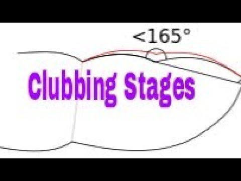 download lagu mp3 mp4 Stages Of Clubbing, download lagu Stages Of Clubbing gratis, unduh video klip Stages Of Clubbing