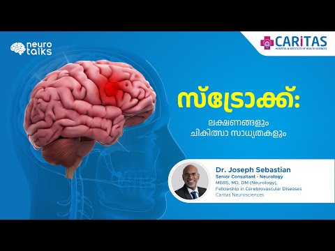 Stroke: Symptoms and Treatment Options
