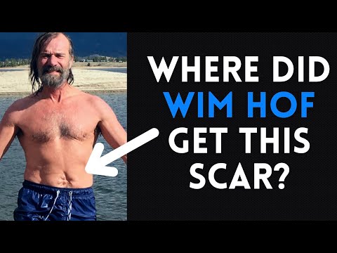 Where Did Wim Hof Get this Scar?