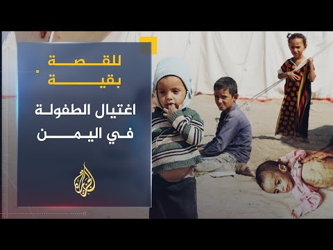 للقصة بقية اغتيال الطفولة في اليمن