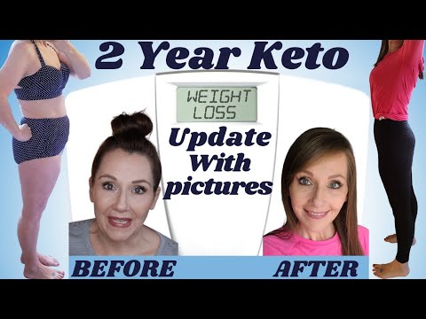 2 Year Weight Loss Update💙KETO/LOW CARB Plus Tips To Succeed