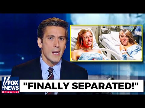 Shocking News: Abby and Brittany, the Famous Conjoined Twins, Can Be Separated!"