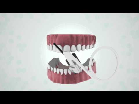 download lagu mp3 mp4 Carestream Verse, download lagu Carestream Verse gratis, unduh video klip Carestream Verse