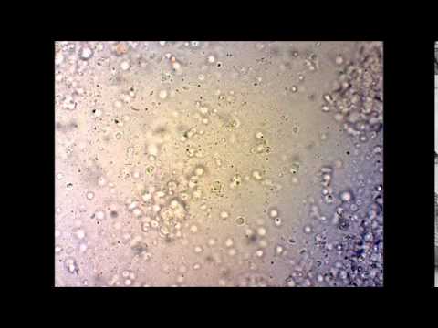 Watch Video on YouTube